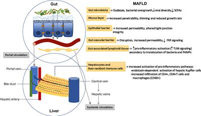 The Role of the Gut-Liver Axis in Metabolic Dysfunction-Associated Fatty Liver Disease